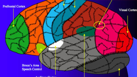 Durch ein spezielles Gerät und Aktivierung der Sehhirnrinde (im Bild rot gekennzeichnet) können Blinde "sehen".