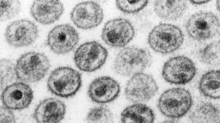Die Zahl der HIV-Infizierungen unter Homosexuellen hat sich seit 2005 verdoppelt. (Im Bild: HIV-Viren unter dem Mikroskop)