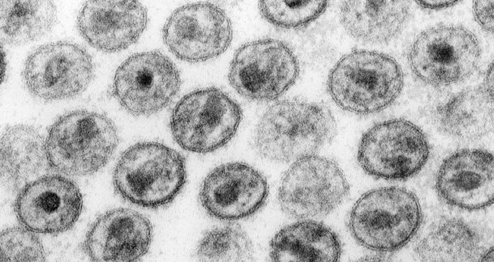 Die Zahl der HIV-Infizierungen unter Homosexuellen hat sich seit 2005 verdoppelt. (Im Bild: HIV-Viren unter dem Mikroskop)