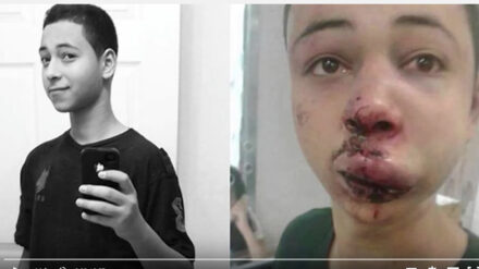 Tarik Abu Chdeir wurde von zwei israelischen Grenzpolizisten brutal geschlagen