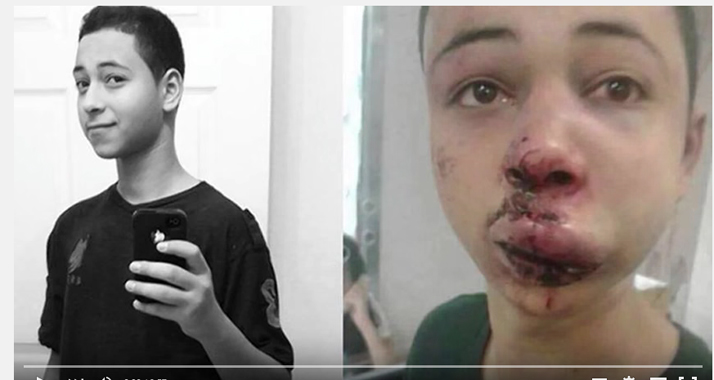 Tarik Abu Chdeir wurde von zwei israelischen Grenzpolizisten brutal geschlagen