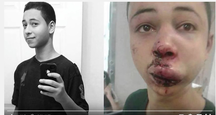 Tarik Abu Chdeir wurde von zwei israelischen Grenzpolizisten brutal geschlagen