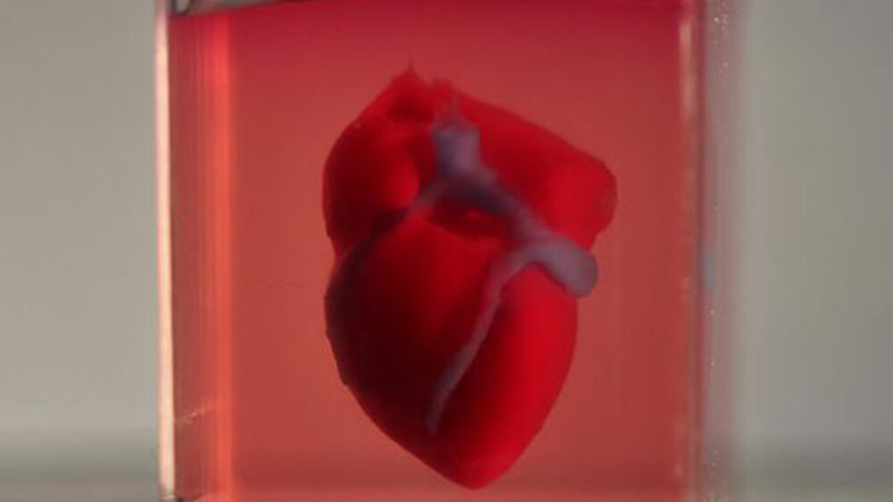 Frisch aus dem Drucker: Ein Herz aus echten menschlichen Zellen