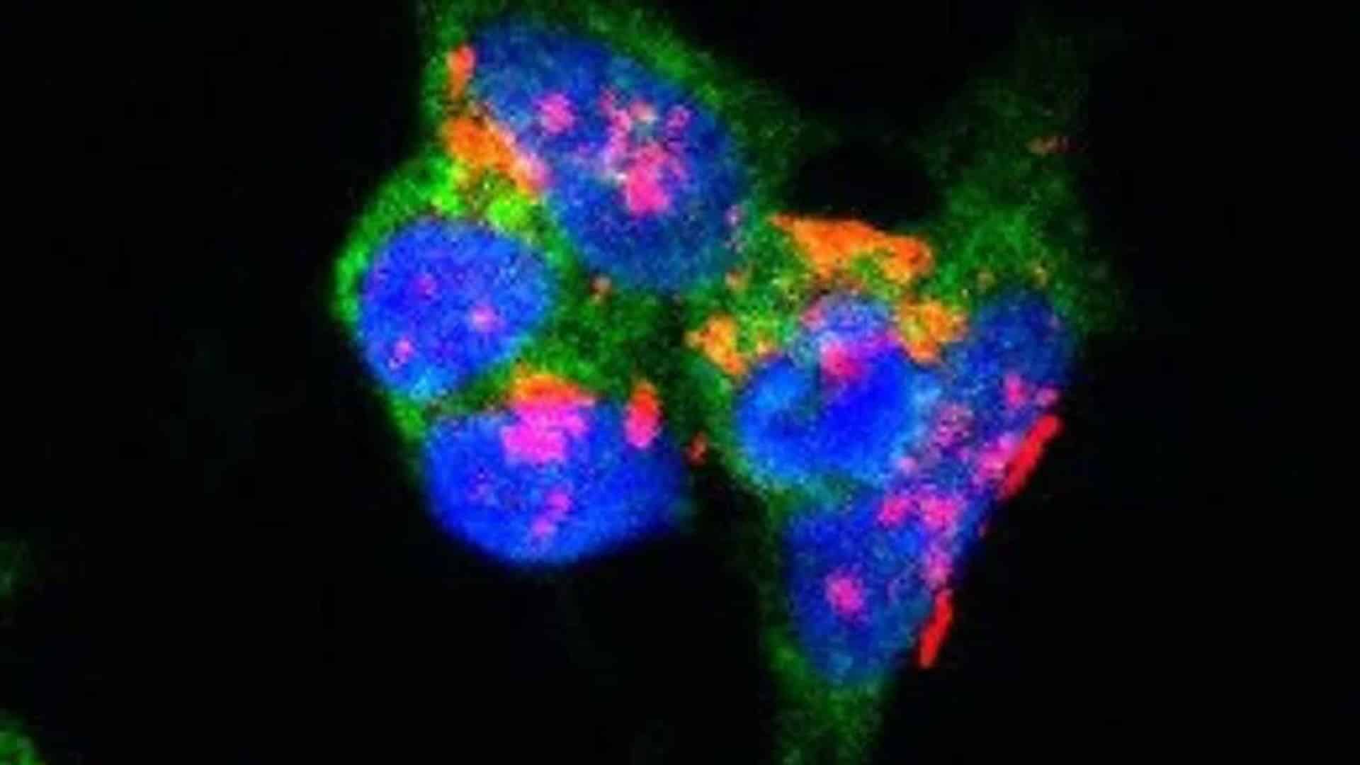 パーキンソンの血液検査は、症状が発生する前に発見されます